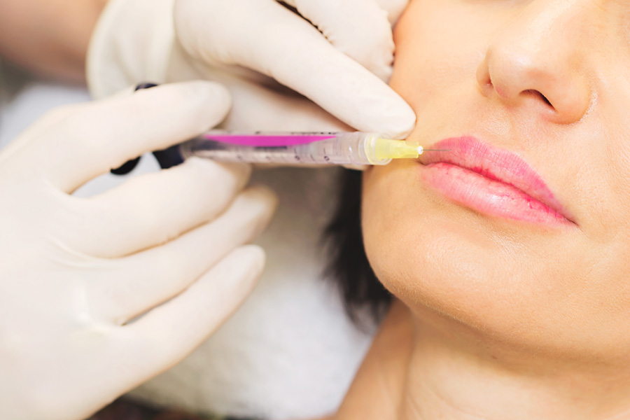 Hyaluronic Acid-based Dermal Fillers Market by Application (Scar Treatment, Lip Enhancement, Wrinkle Correction Treatment, Restoration of Volume / Fullness), by End User (Specialty & Dermatology Clinics, Hospitals & Clinics) – Global Outlook & Forecast 2022-2030