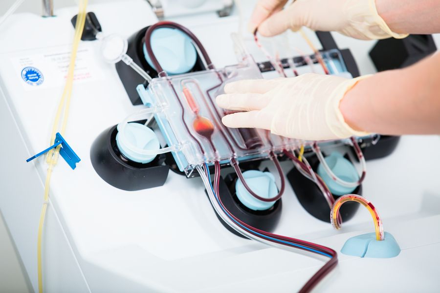 Autotransfusion Devices Market by Product Type (Autotransfusion Devices and Consumables & Accessories), by Application (Neurological Surgeries, Cardiovascular Surgeries, Orthopedic Surgeries, Obstetrics & Gynecological Surgeries, and Others), By End-User (Hospitals and Specialty Clinics & Others) - Global Outlook & Forecast 2022 -2030