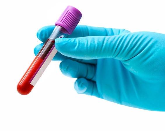 Serological Testing Market by Product (Instruments and Consumables), by Technology Enzyme-linked Immunosorbent Assay (ELISA), Nucleic Acid Testing (NAT), Chemiluminescence Microparticle Immunoassay (CMIA), and Lateral Flow Assay), by Application (Blood Group Detection, COVID-19, Dengue, Torch Test, Hepatitis B, Hepatitis C, HIV, Malaria, Syphilis, and Others), by End-user (Hospitals, Blood Banks, Diagnostic Centers, and Academic & Research Institutes) – Global Outlook & Forecast 2022-2030