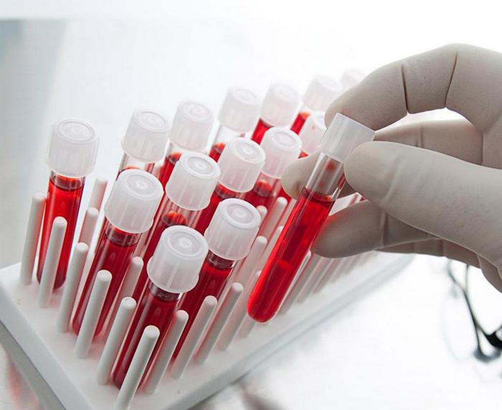 Blood Screening Market by Technology (ELISA, Western Blot, RT-PCR, Rapid Test, Nucleic Acid Amplification), by Product (Software, Instrument, Reagent & Kits), and by End-User (Hospital-based Laboratories, Independent Laboratories)– Global Outlook & Forecast 2022-2030