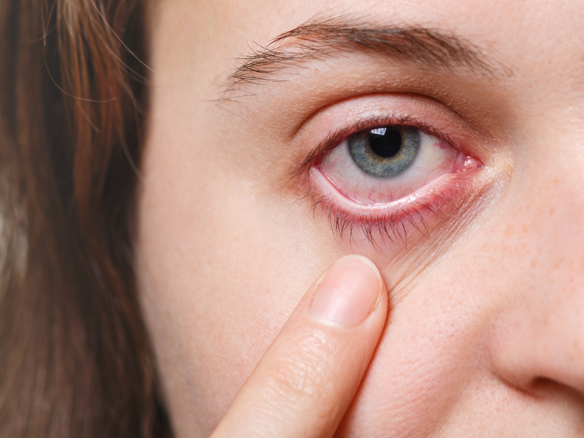 Dry Eye Market by Drug Class (Anti-Inflammatory Agents, Topical Corticosteroids, Artificial Tears, Oral Omega Supplements, and Others), by Disease Type (Evaporative Dry Eye Syndrome and Aqueous Dry Eye Syndrome), by Distribution Channel (Hospital Pharmacies, Eye Health Clinics, Retail Pharmacies, and Online Pharmacies) – Global Outlook & Forecast Period 2022-2030