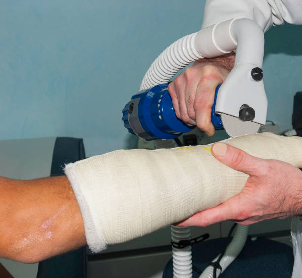 Cast Removal Devices Market by Saw Type (Electric Cast Saw, Pneumatic-powered Cast Saw), Application (Plaster of Paris Cast Removal, Fiberglass Casting Tape Removal), End-user (Hospitals, Orthopedic Clinics) – Global Outlook & Forecast 2022-2030