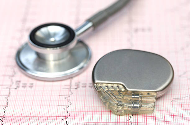 Implantable Cardiac Monitor Market by Indication (Atrial Fibrillation, Cardiac Arrhythmia, Epilepsy, Others), End-user (Hospitals, Ambulatory Surgical Centers, Cardiac Centers) – Global Outlook & Forecast 2022-2030