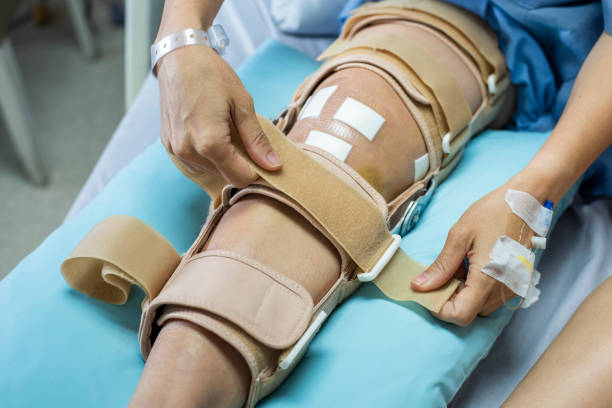 Orthopedic Splints Market by Product (Fiberglass Splints, Plaster Splints), Application (Lower Extremity, Upper Extremity), End-user (Hospitals, Ambulatory Surgery Centers) - Global Outlook and Forecast 2020-2030