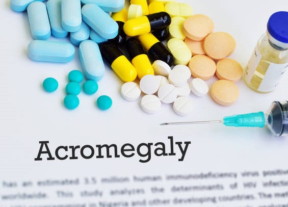 Acromegaly Market by Drug Class (Somatostatin Analogs, Dopamine Agonists), Distribution Channel (Hospital Pharmacies, Retail Pharmacies) - Global Outlook and Forecast 2023-2031