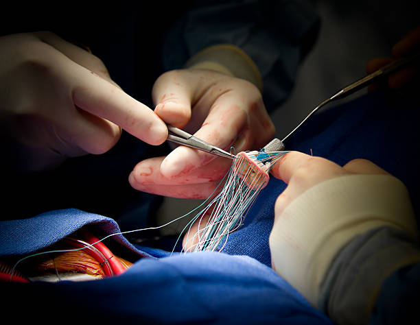 Cardiac Sutures Market by Product (Non-absorbable Sutures, Absorbable Sutures), Material (Natural, Synthetic), Type (Monofilament, Multifilament), End User (Hospitals, Ambulatory Surgical Centers) - Global Outlook and Forecast 2023-2031