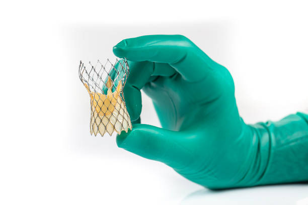 Aortic Valve Replacement Devices Market by Surgery (Open Surgery, Minimally Invasive Surgery), Product (Transcatheter Aortic Valve, Suture-less Valve), End User (Hospitals, Ambulatory Surgery Centers) - Global Outlook and Forecast 2023-2031