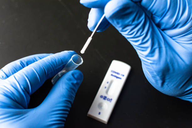 COVID-19 Diagnostic Testing Market by Product & Services (Reagents & Kits, Instruments), Sample Test (Nasopharyngeal (NP) Swabs, Nasal Swabs), Test Type (Molecular (PCR) Testing, Others), Mode (Point-of-Care), End User (Laboratories, Hospital) – Global Outlook & Forecast 2023-2031