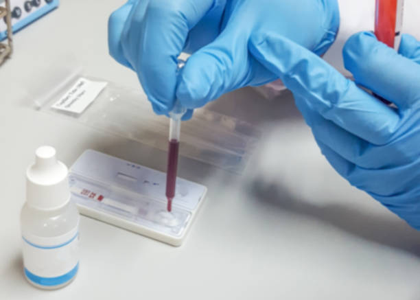 Mono Rapid Testing Market by Type (Mono-spot Test, Complete Blood Count Test), End User (Hospital, Speciality Clinics) – Global Outlook & Forecast 2023-2031